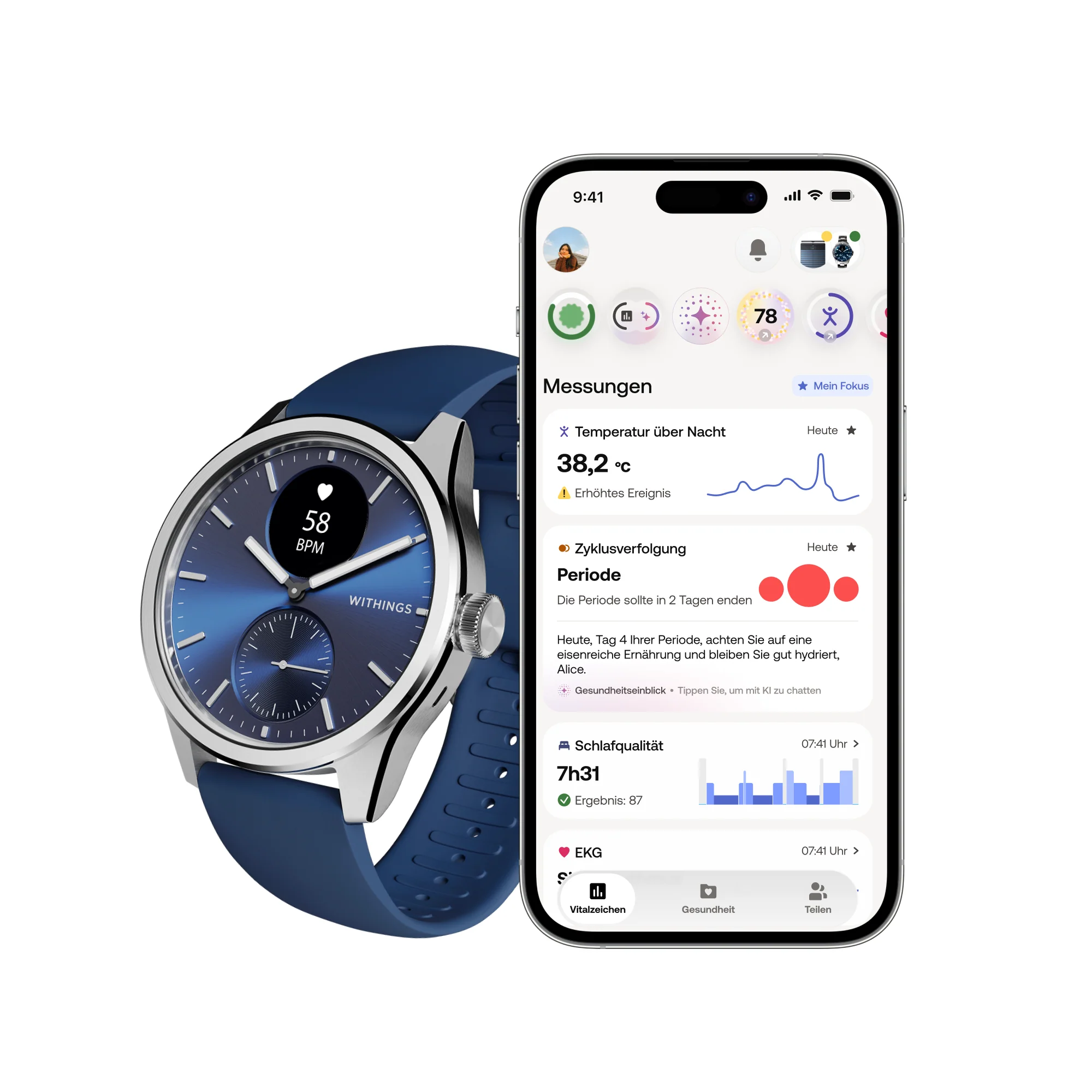Withings ScanWatch 2 - Blau 42mm + Gratis Withings Lederarmband in Schwarz - Image 5